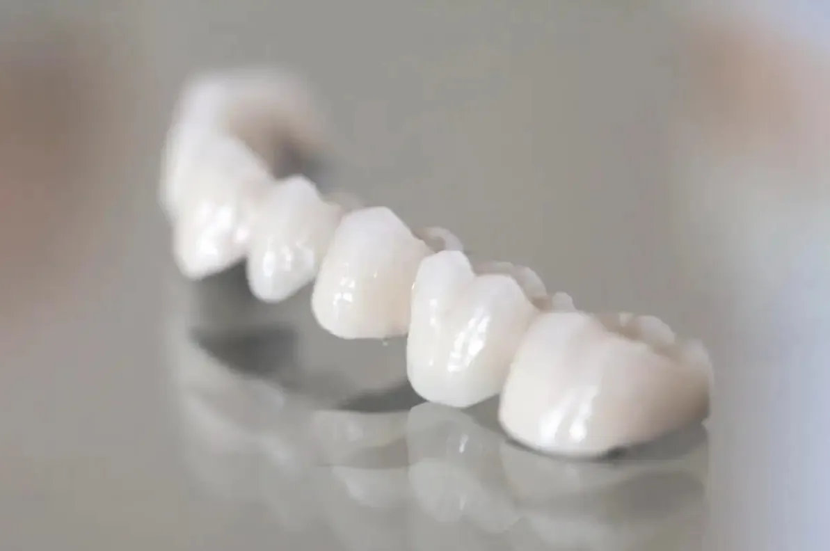 Dental Prosthetics
