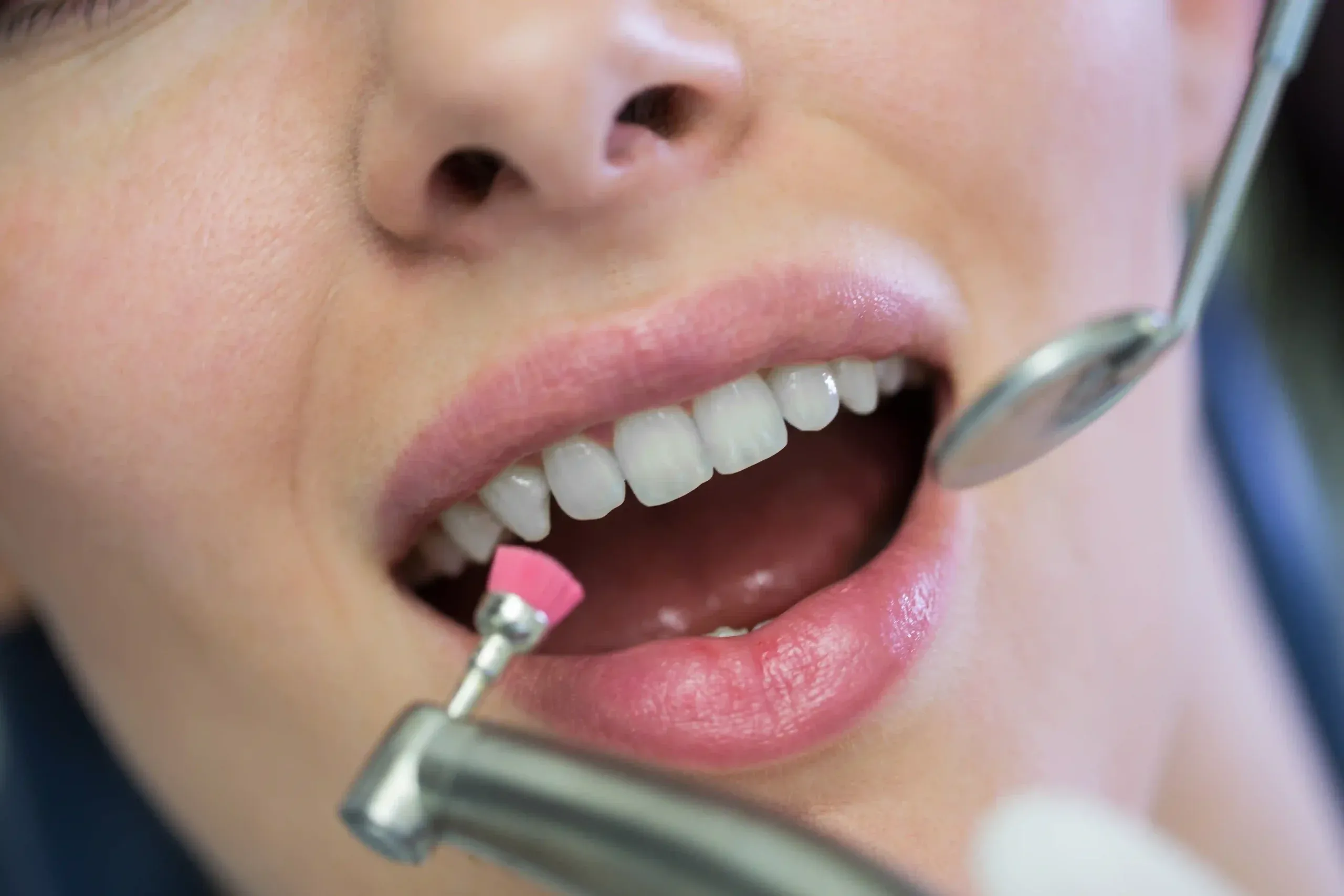 Aesthetic Dentistry