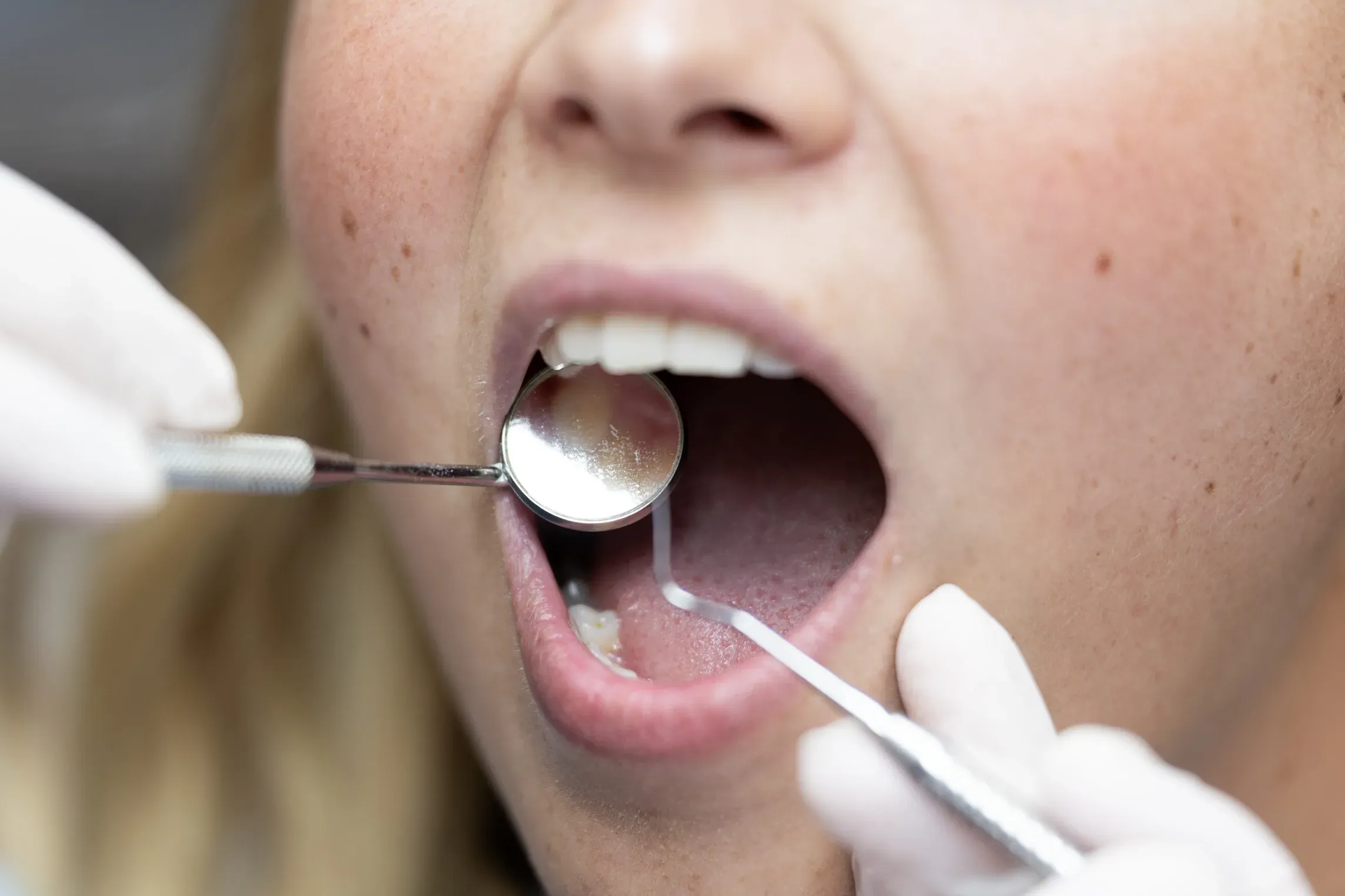 Conservative Dentistry